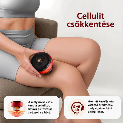Livendis™ PulseMass intelligens vákuumos köpölyöző, elektromos Gua Sha terápiás masszírozó